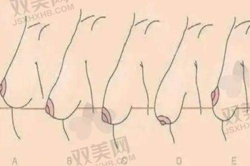 明确硬块形成原因