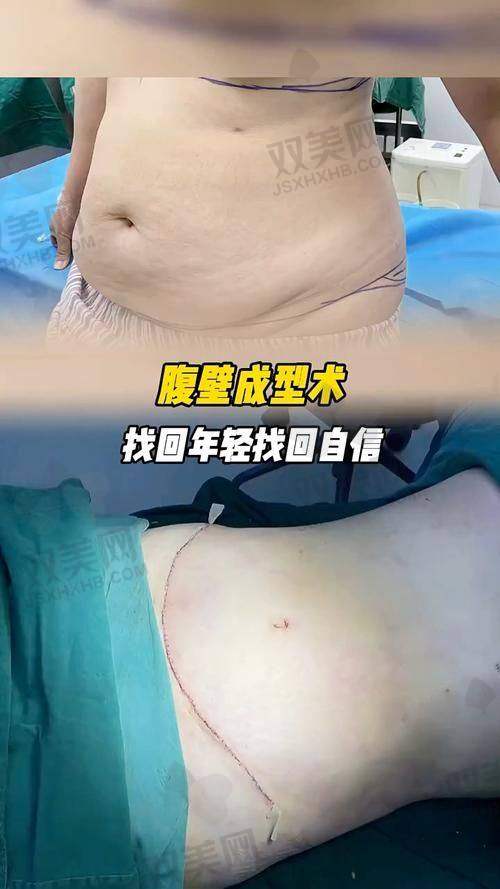 【韩国史丹利医院是私立还是公办】