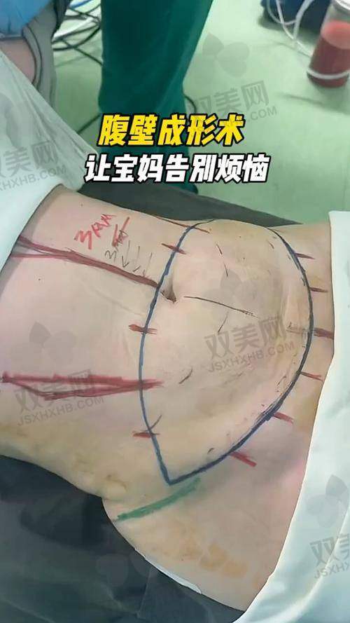 【韩国史丹利医院技术特点】