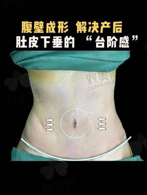 【韩国史丹利医院是正规的吗】