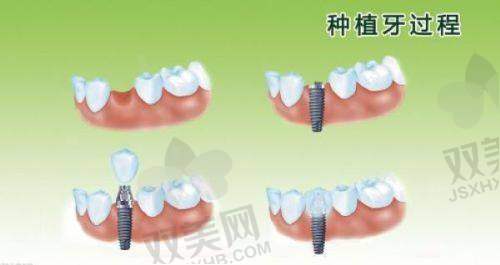 【北京海淀中诺口腔医院怎么预约挂号】