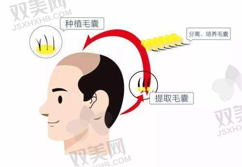 【广州美恩医疗美容医院植发科怎么预约挂号】