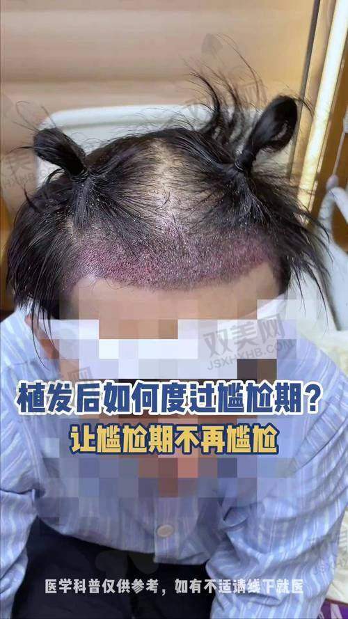 【广州美恩医疗美容医院植发科是私立还是公办】