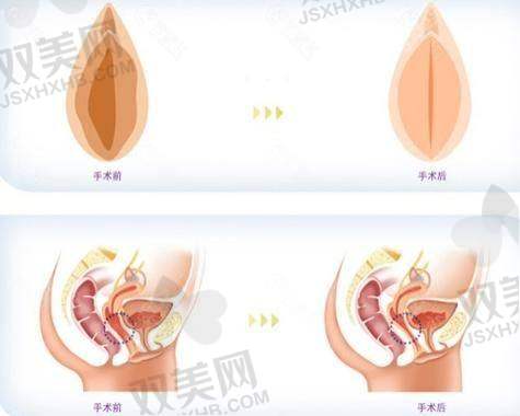 五、价格多少？做一次内阴/外阴/盆底分别多少钱？