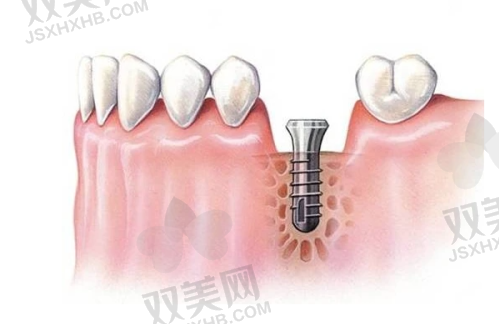 【北京拜博口腔青年路门诊部电话号码是多少】