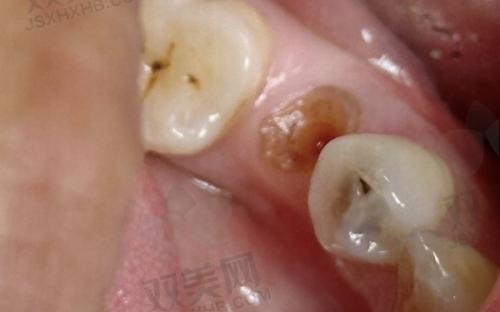 【北京维乐口腔门诊部（马连道院区）是正规的吗】