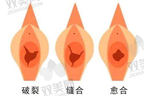 广州建国医院私密科医生名单