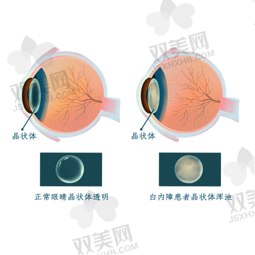 五、“高端vs基础”晶体要不要加钱？一图看明白！