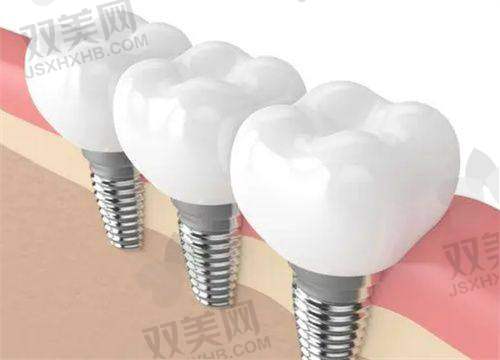 【北京诺美口腔门诊部大屯店擅长什么项目】
