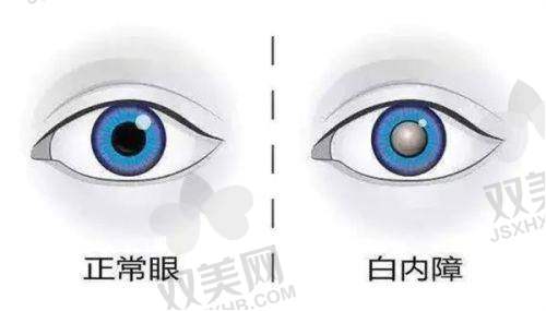 王薇医生手术实例