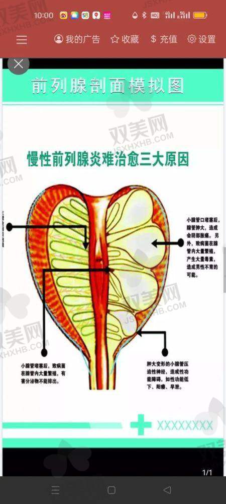 男性埋线降敏术有后遗症吗？