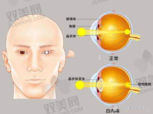 王薇医生手术价格