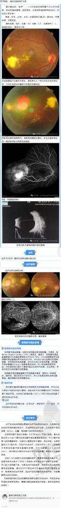马志中的“擅长”项目到底有多强？