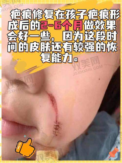 韩国安成烈整形外科技术特点