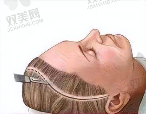 其他口腔服务