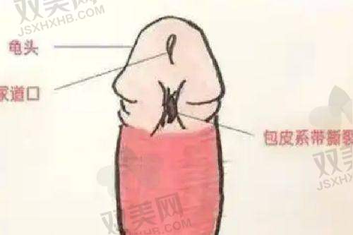 凯丽国内外ksa丰胸的原理是什么?
