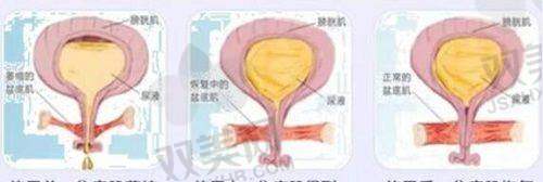 环保的辅助材料