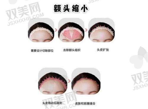严格的质量把控