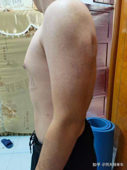 如何选择正规的延长手术医院和医生？