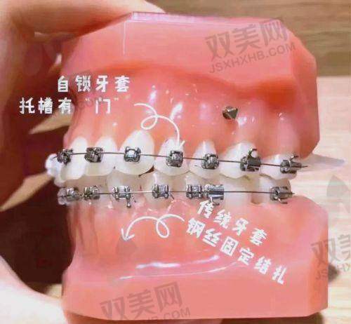 三、佩戴体验差距大不大？口感、异物感、舒适度实测反馈来了！