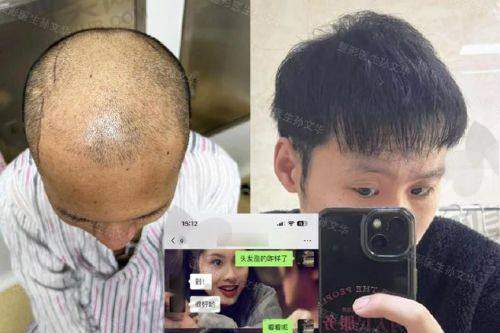 【怀化星美医疗美容医院植发科电话号码是多少】