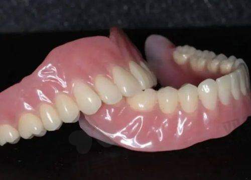 西安诺贝尔口腔种植牙的费用情况