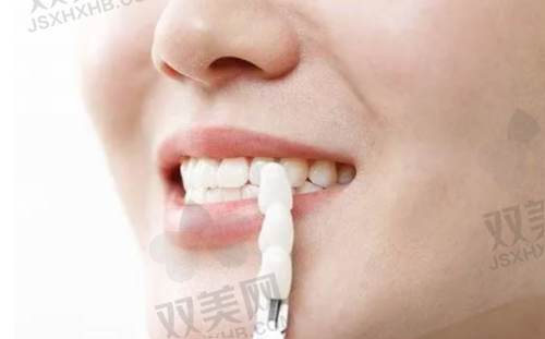 种植牙齿的品牌差异