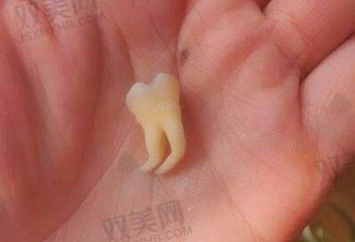 项目复杂程度不同
