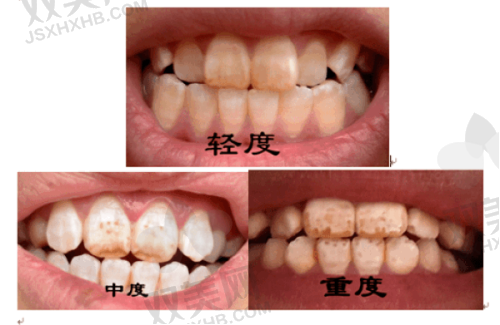 影响价格的因素