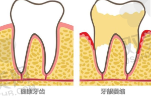 正规医院牙科挂号方式