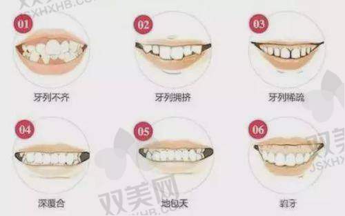 螺丝固位修复方式