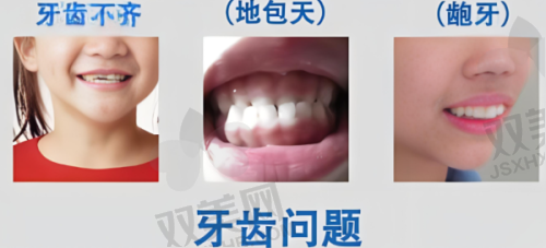 不同材质假牙的特点与价格