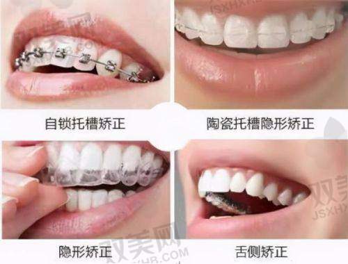 正规医院牙科具体位置