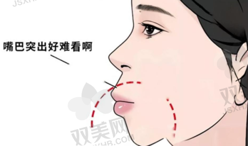 影响门牙种植价格的因素