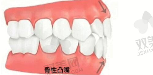 影响牙齿治疗费用的因素