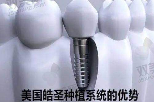 成都地区优质门牙种植医院