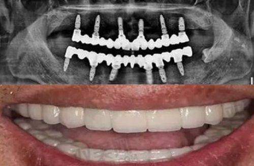 患者个体情况影响费用