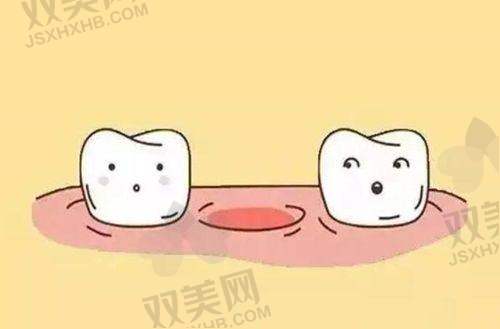 种牙价格参考范围