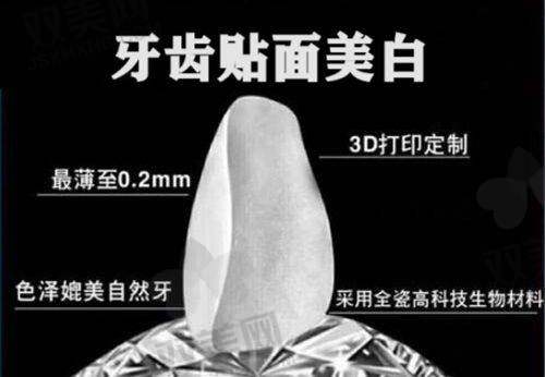 牙齿种植技术的种类