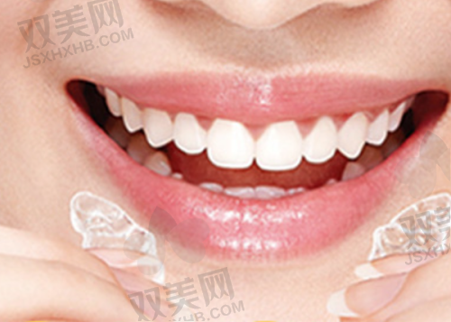冷光美白牙齿的适用人群有哪些?