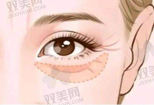 三、手术前的准备