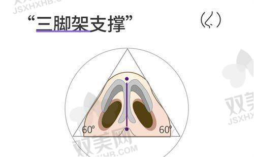 傲诺拉璀璨假体的术后护理要点