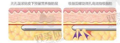 傲诺拉绚耀系列