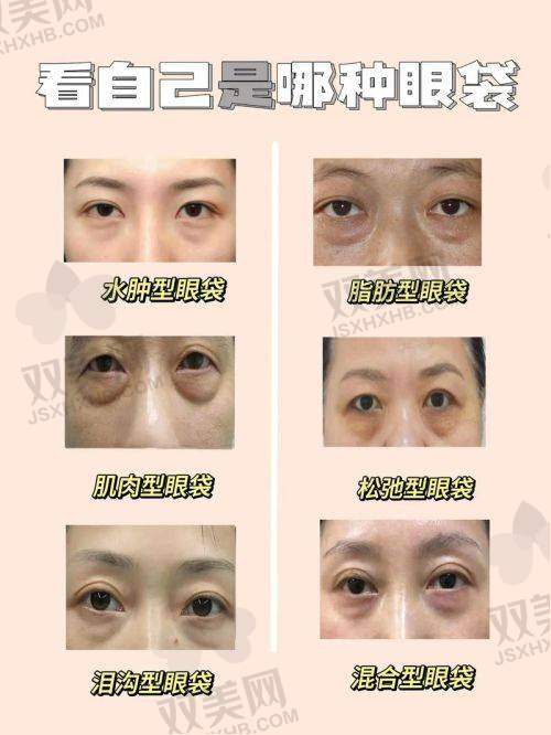 五、手术后的护理