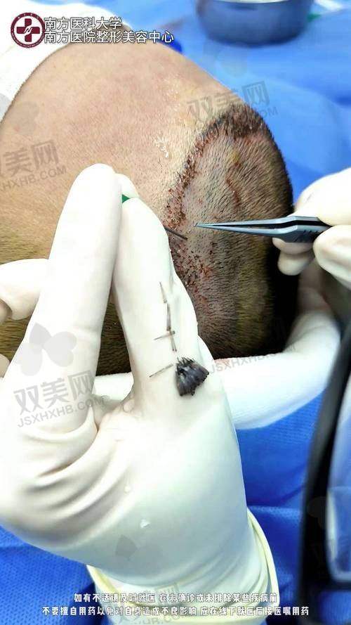 【深圳悦尔医疗美容医院植发科怎么预约挂号】