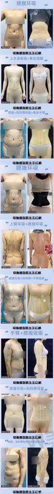 【深圳南雅医疗美容门诊部是正规的吗】