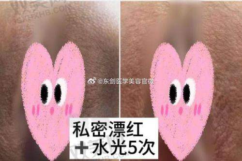 【深圳美博瑞医疗美容医院电话号码是多少】