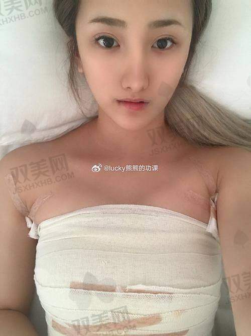 如何根据傲诺拉隆胸成效图选择适合自己的方案