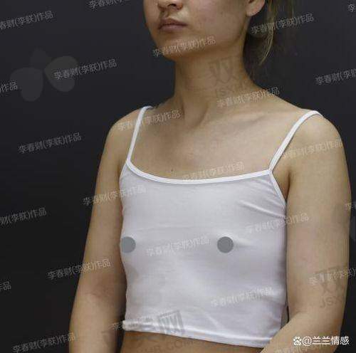 傲诺拉璀璨假体价格分析
