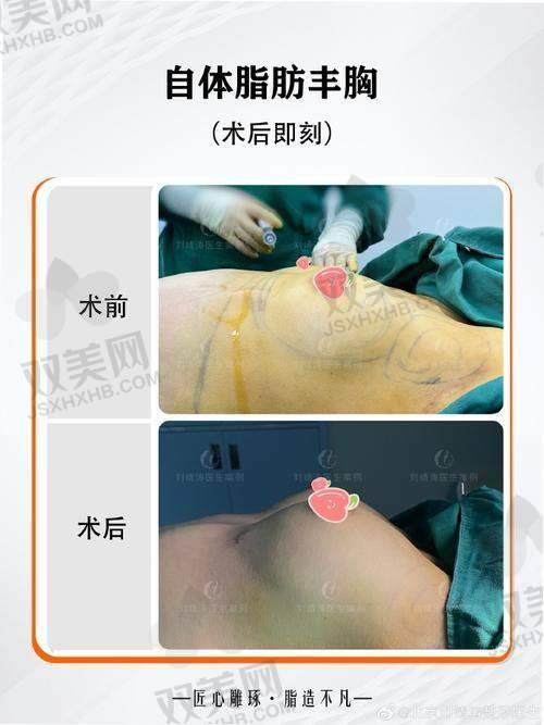 星耀系列的独特规格与适用人群